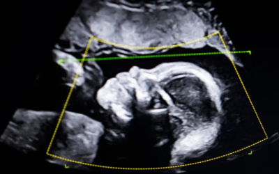 BioticsAI Secures FDA Approval for AI-Powered Fetal Ultrasound After 2023 Disrupt Battlefield Win